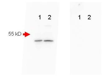 APP / Beta Amyloid Precursor Antibody