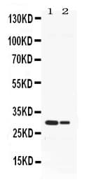 HNE / Neutrophil Elastase Antibody
