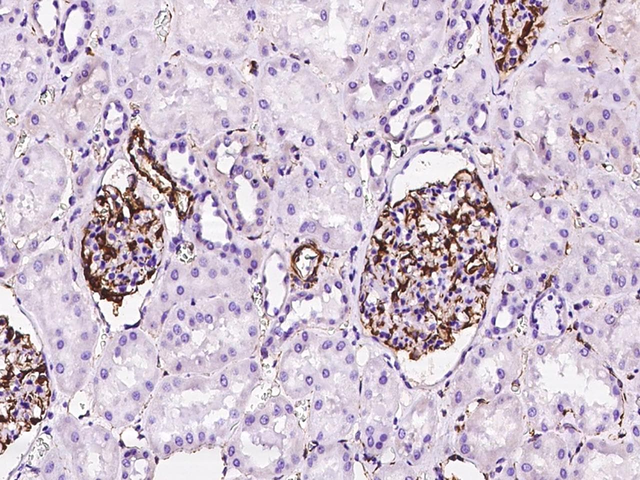 NES / Nestin Antibody