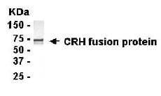 CRH / CRF Antibody (aa27-196)
