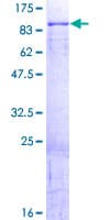 Human SMIF / DCP1A Protein (Recombinant GST)