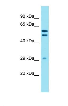 DHRS12 Antibody (aa64-113)