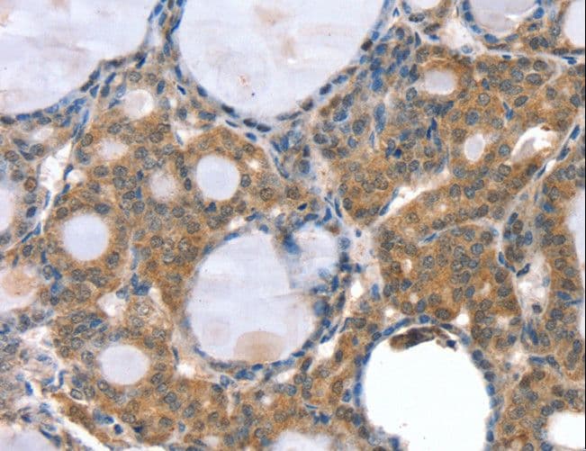 GNAT3 / Gustducin Antibody