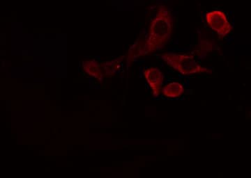 TS / Thromboxane Synthase Antibody
