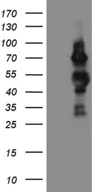 Monoclonal Mouse anti-Human CDC25B Antibody (clone OTI6H9, aa421-567, WB)