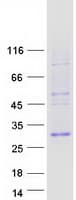 Human TWIST1 / TWIST Protein (Recombinant Myc-DDK (Flag))