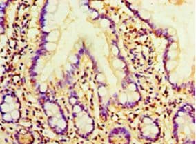 AMH / Anti-Mullerian Hormone Antibody (aa26-560)