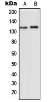 Polyclonal Rabbit anti-Human GRM2 / MGLUR2 Antibody (C-Terminus, WB)