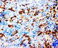 PTGS1 / COX-1 Antibody (N-Terminus, Sepharose)