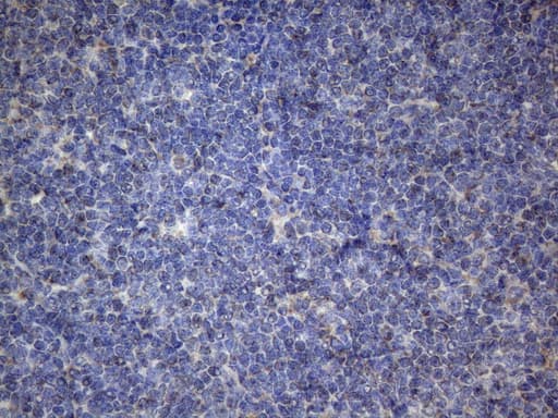 PPIF / Cyclophilin F Antibody (clone OTI1C4)