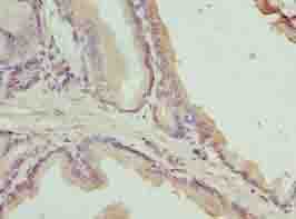 C17orf64 Antibody