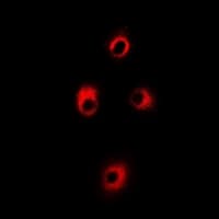Polyclonal Rabbit anti-Human ALAS1 Antibody (IF, WB)