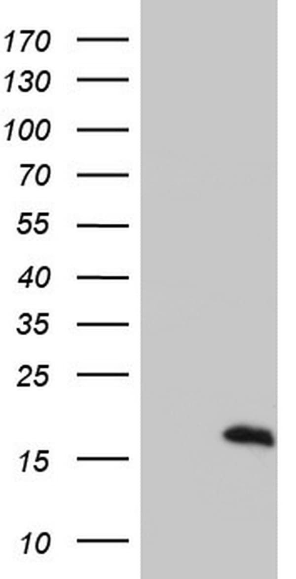 Monoclonal Mouse anti-Human S100A9 / MRP14 Antibody (clone OTI10D5, IHC, WB)