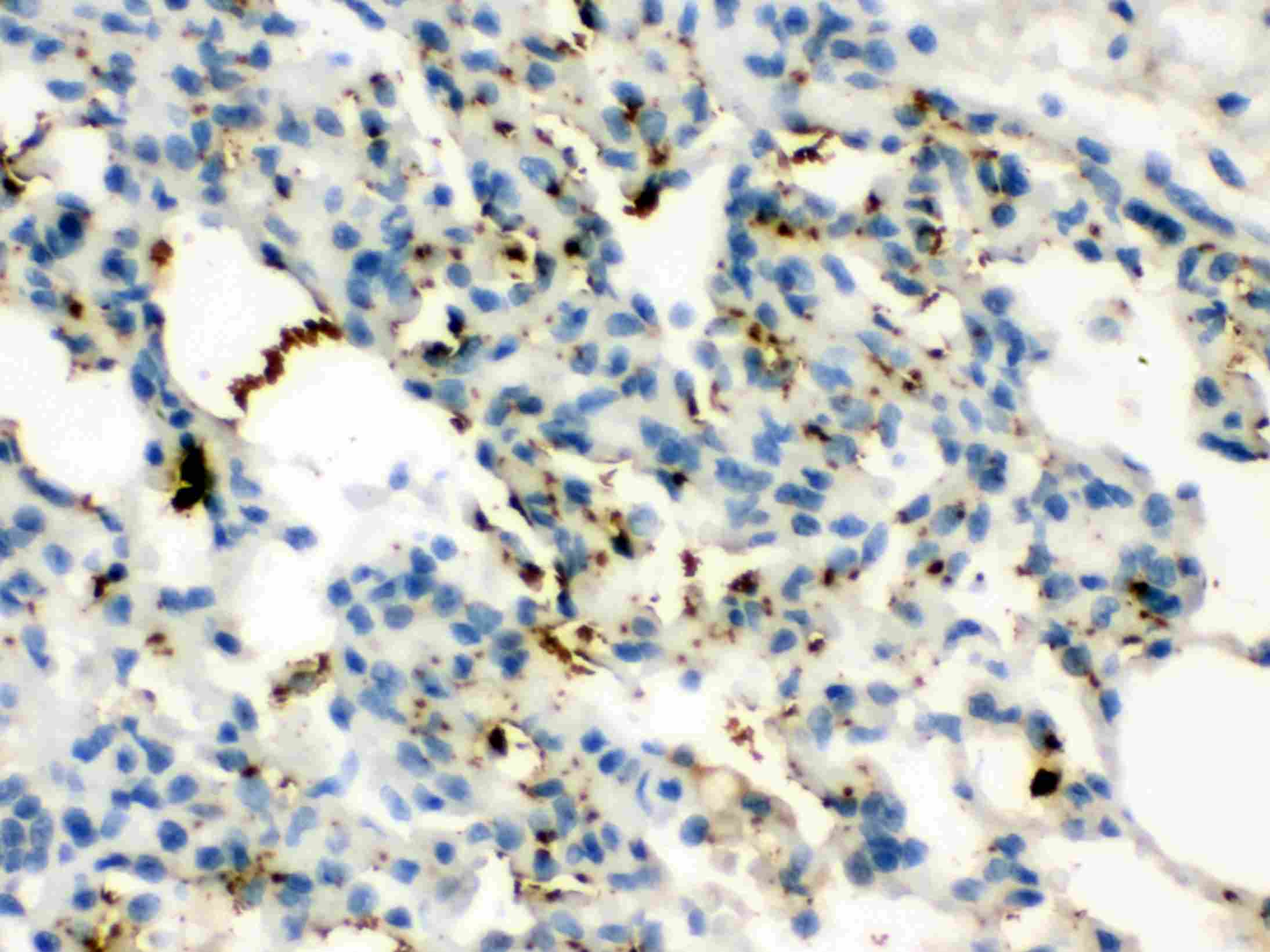 CALCA Antibody