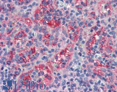 PRF1 / Perforin Antibody (aa120-353)