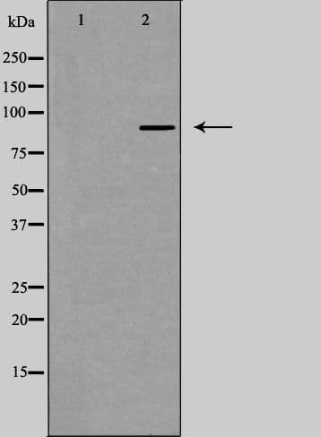 Polyclonal Rabbit anti-Human DYRK / DYRK1A Antibody (IF, WB)