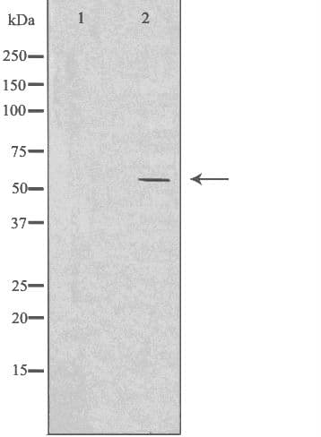 IKZF2 / HELIOS Antibody