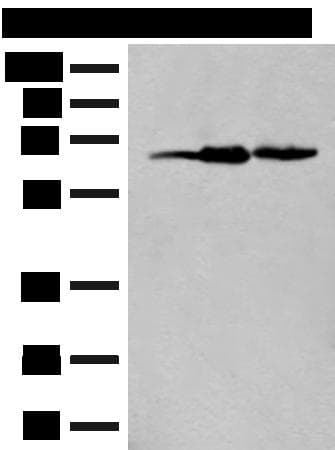 EXOSC9 / p5 Antibody