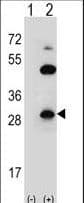 CLDN2 / Claudin 2 Antibody (aa200-227)