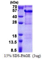Human DBR1 Protein (Recombinant His)