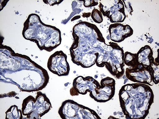 KRT84 / Keratin 84 / KRTHB4 Antibody (clone OTI2D1, Carrier-free)