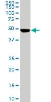 Monoclonal Mouse anti-Human PNMA1 / MA1 Antibody (clone 4G6, IHC, WB)