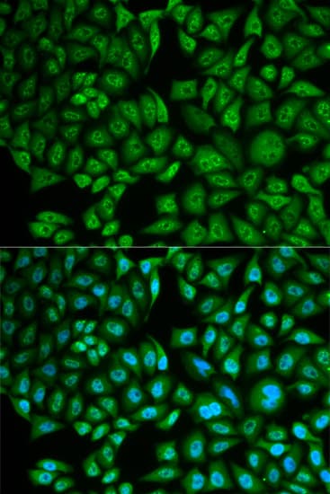 CTSA / Cathepsin A Antibody