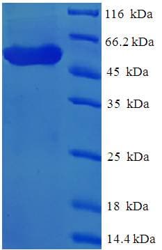 Human SCML4 Protein (Recombinant His-SUMO)