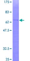 Human GPS2 Protein (Recombinant GST)