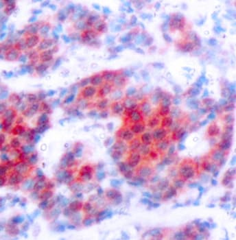 STAT4 Antibody (phospho-Tyr693)