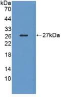 LRP1B Antibody