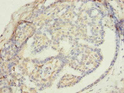 ZNF626 Antibody