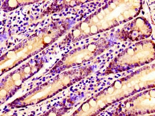 Polyclonal Rabbit anti-Human SSX2IP Antibody (IHC, IF, WB)