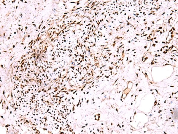 Polyclonal Rabbit anti-Human CDKN1B / p27 Kip1 Antibody (IHC)