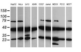 MAP2K1 / MKK1 / MEK1 Antibody (clone OTI2A1, Carrier-free)