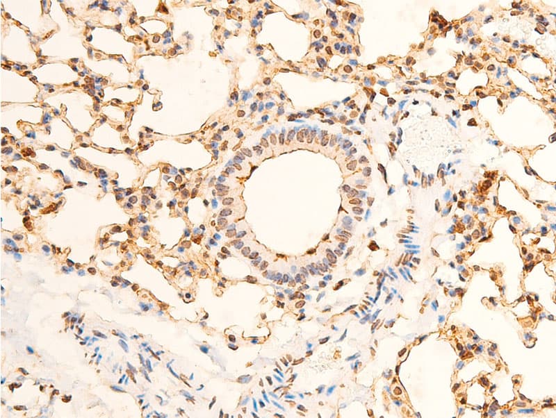 Polyclonal Rabbit anti-Human EIF2S1 Antibody (phospho-Ser51, IHC, IF, WB)