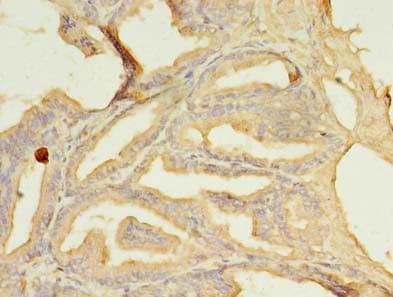 Polyclonal Rabbit anti-Human SFXN2 Antibody (IHC)