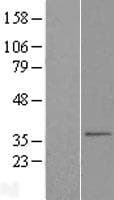 SLC25A38 Protein (Over-Expression Lysate Myc-DDK (Flag))