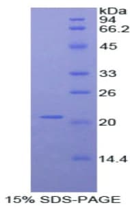 Mouse ADAMTS12 Protein (Recombinant His)
