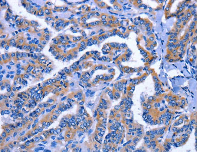 IGSF10 Antibody