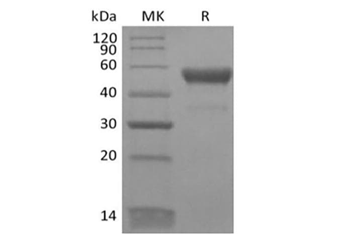 Human CD300LB Protein (Recombinant Fc, C-terminus)