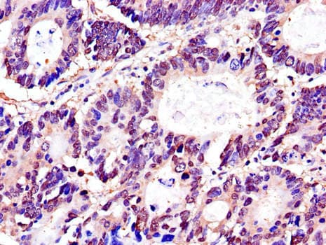 YWHAZ / 14-3-3 Zeta Antibody
