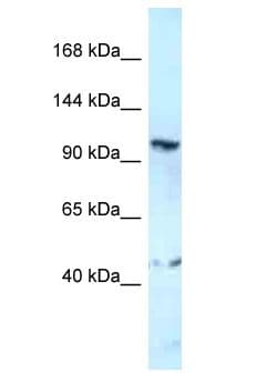 GRIK4 / KA1 Antibody (aa894-943)