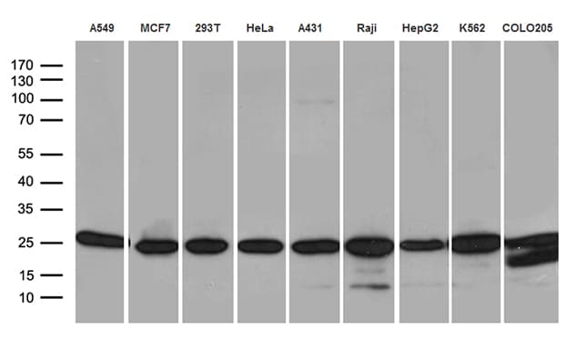 Monoclonal Mouse anti-Human PSMA7 Antibody (clone OTI10A6, WB)