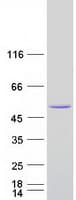 Human ARFGAP1 Protein (Recombinant Myc-DDK (Flag))