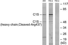 Complement C1s Antibody (aa388-437)