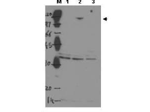 Polyclonal Rabbit anti-Human TP53BP2 / ASPP2 Antibody (IHC, WB)