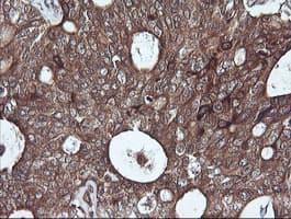 SYP / Synaptophysin Antibody (clone OTI1B10, Carrier-free)