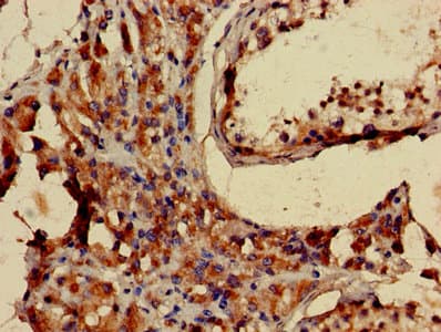 LHCGR / LHR / LH Receptor Antibody (aa27-363)