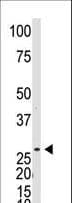 DKKL1 / Soggy-1 Antibody (aa213-242)